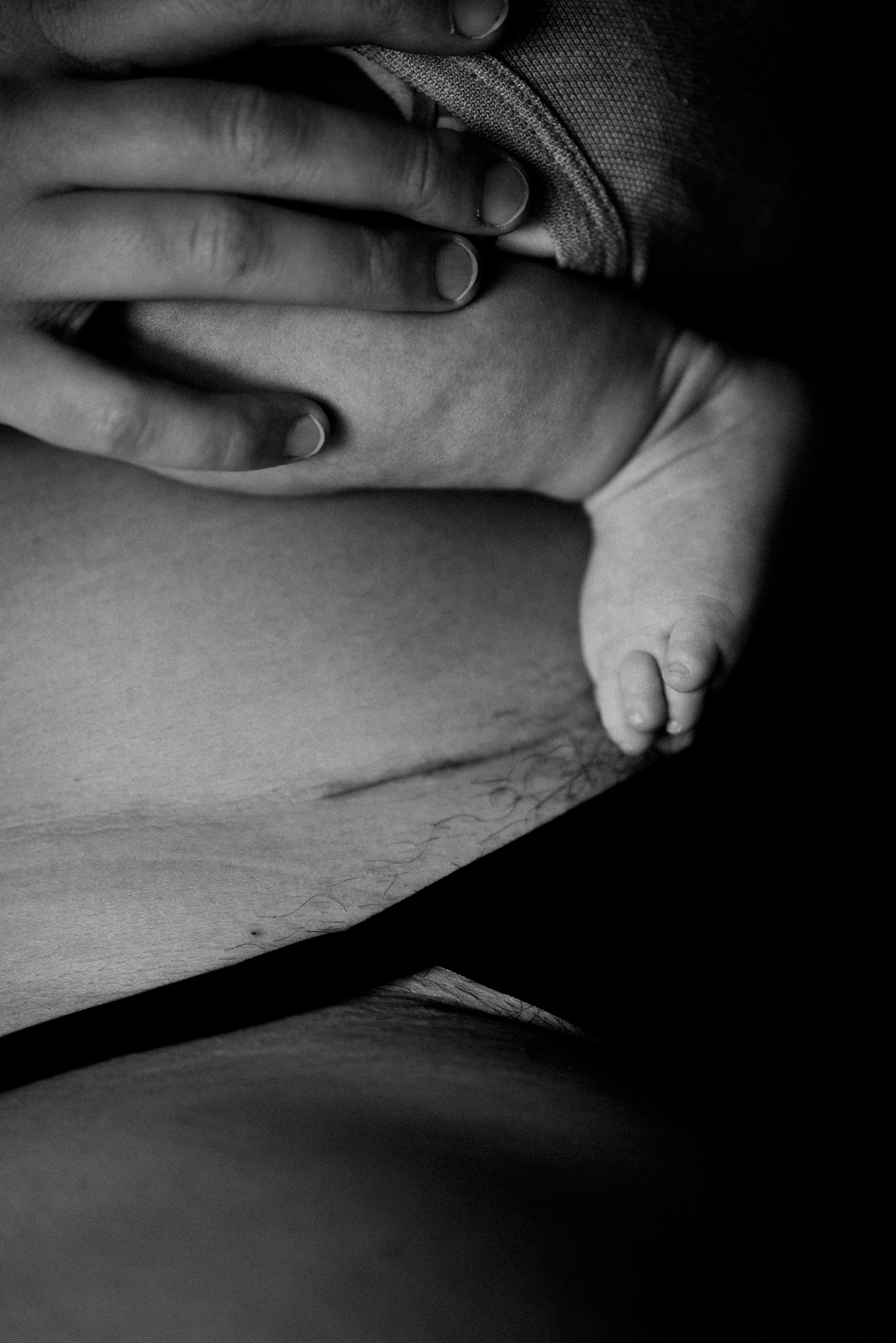 Kaiserschnitt Narbe Detail Wochenbettfotos